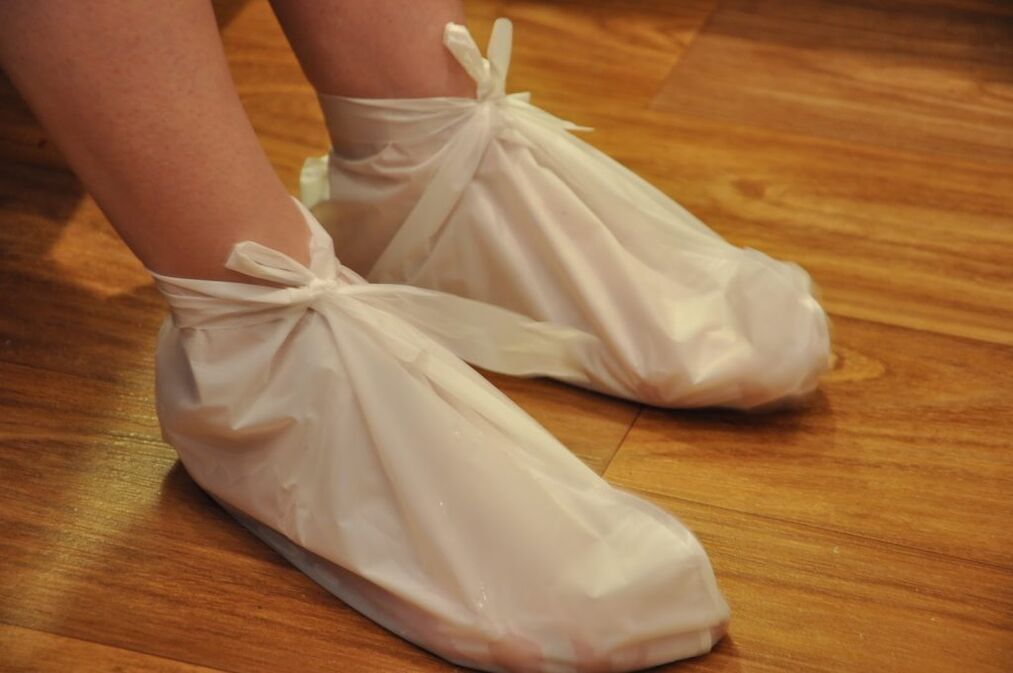 Kompressen bei Sprunggelenksarthrose