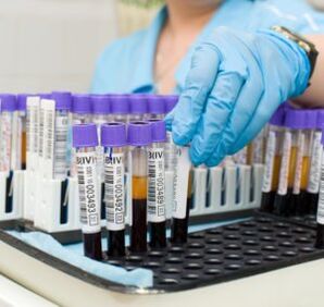 Bluttest zur Diagnose von Gelenkschmerzen