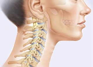 Was sind die Symptome einer zervikalen Osteochondrose 