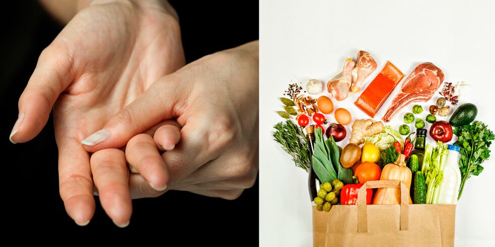 Gichtarthritis der Hände und Lebensmittel zu ihrer Behandlung